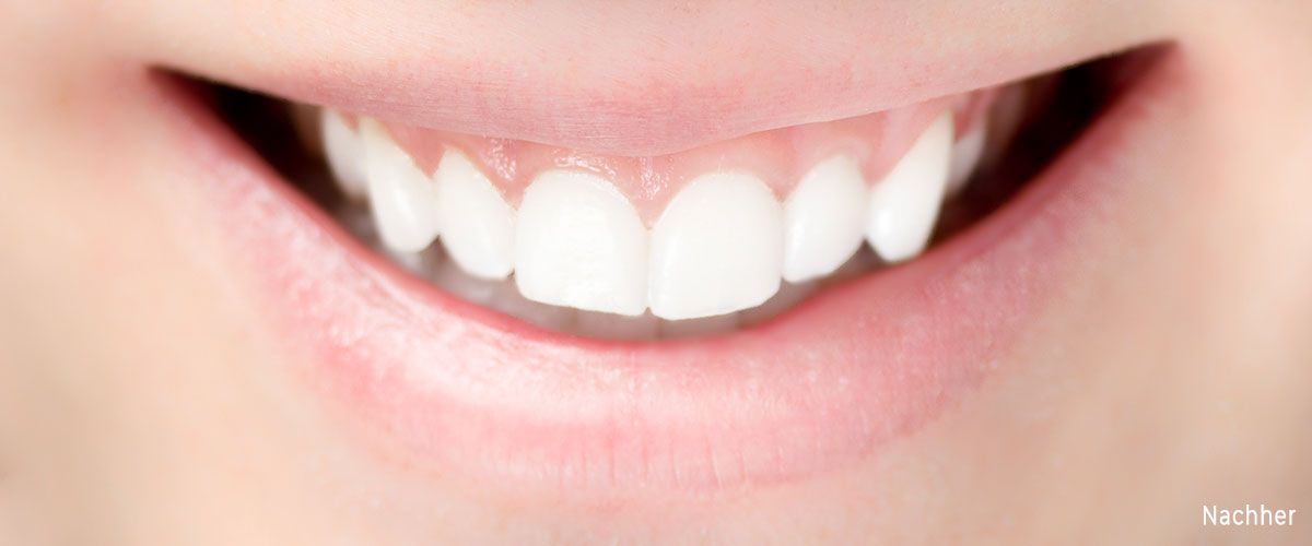 Zahnarzt Kaya Rodgau - Nach der Zahnaufhellung